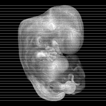 axial slice image map