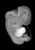 44 day human embryo - MRI animation