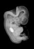 44 day human embryo - MRI animation