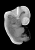 44 day human embryo - MRI animation