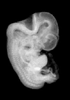 44 day human embryo - MRI animation