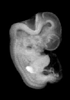 44 day human embryo - MRI animation