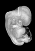 44 day human embryo - MRI animation