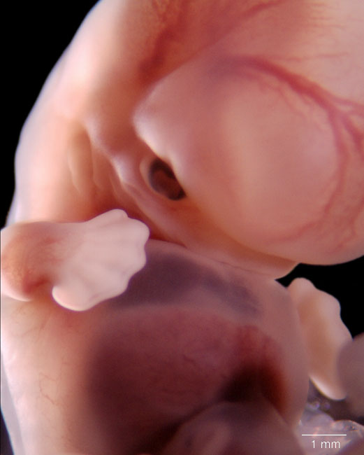 human embryo photograph