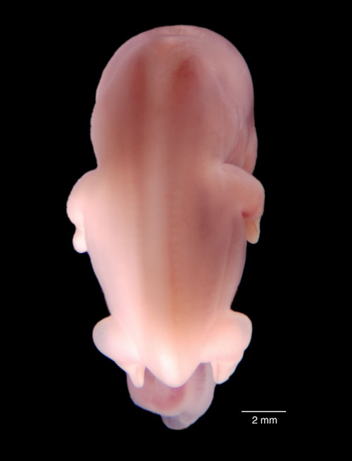 human embryo photograph