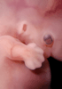 day 44 human embryo photograph