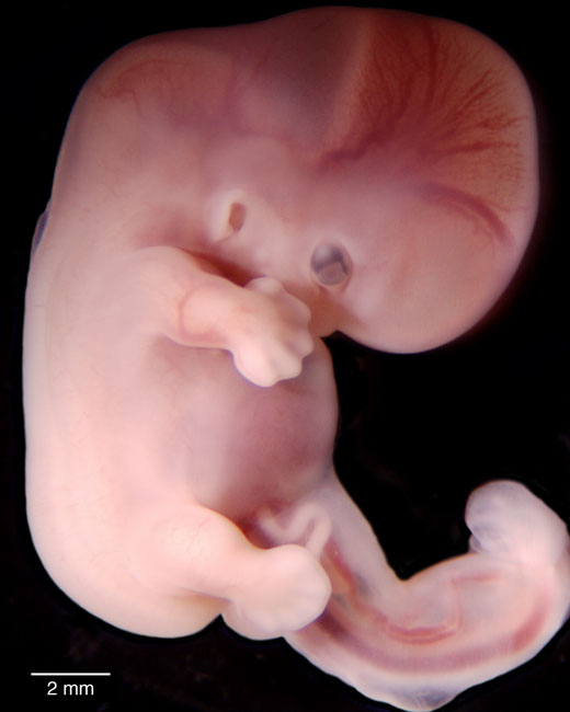 human embryo photograph