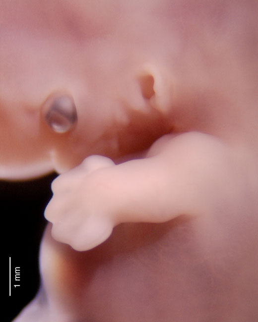 human embryo photograph