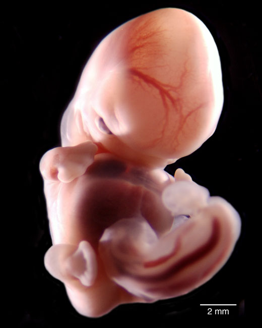 human embryo photograph