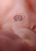 day 44 human embryo photograph