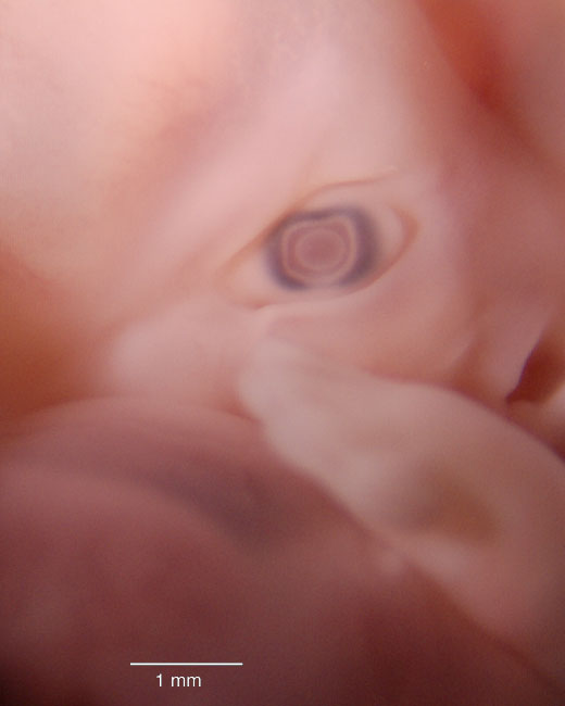 human embryo photograph