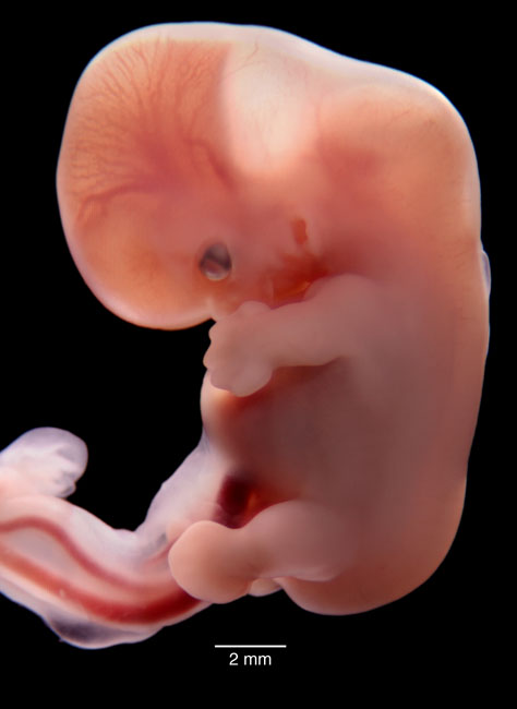 human embryo photograph