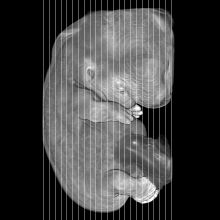coronal slice image map