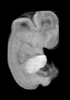 day 47 human embryo MRI animtaion