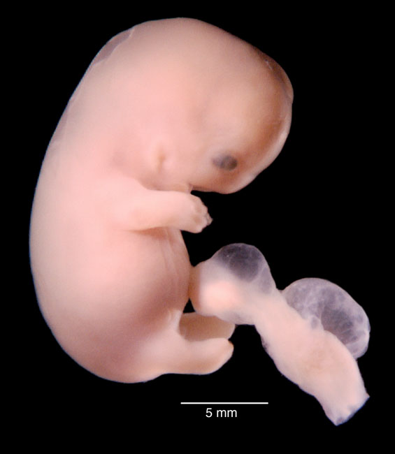 human embryo photograph