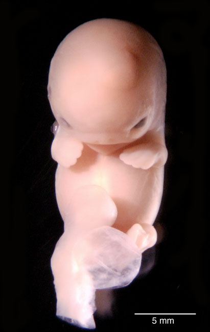 human embryo photograph