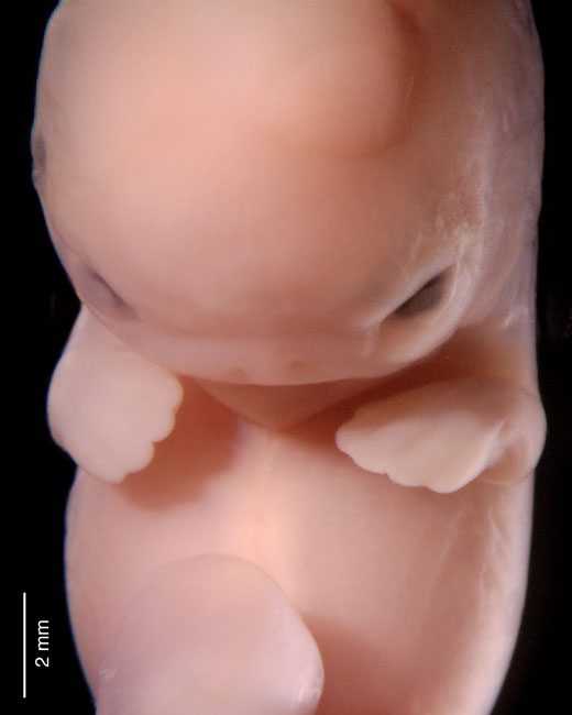 human embryo photograph