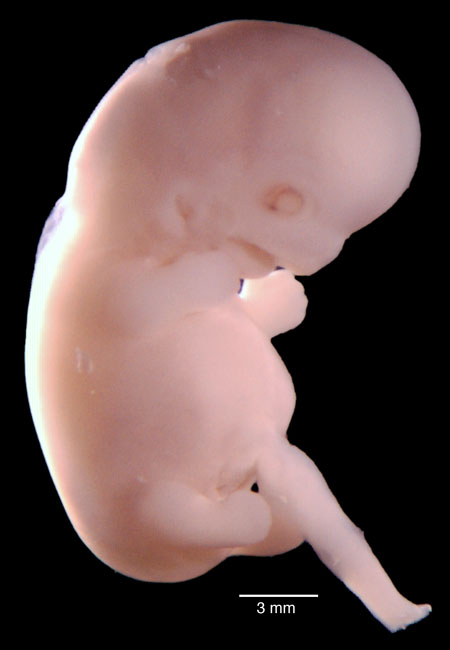 human embryo photograph