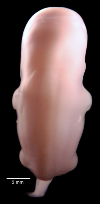 human embryo photograph