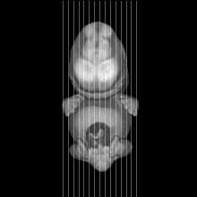 sagittal slice image map