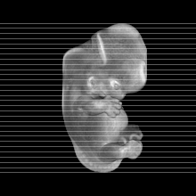 axial slice image map