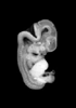 day 50 human embryo MRI animation