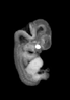 day 50 human embryo MRI animation