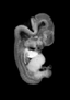 day 50 human embryo MRI animation