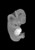 day 50 human embryo MRI animation