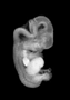 day 50 human embryo MRI animation