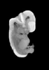 day 50 human embryo MRI animation