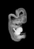 day 50 human embryo MRI animation