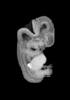 day 50 human embryo MRI animation