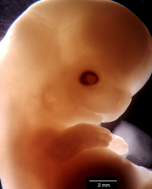 human embryo photograph