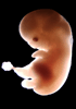 day 50 human embryo photograph