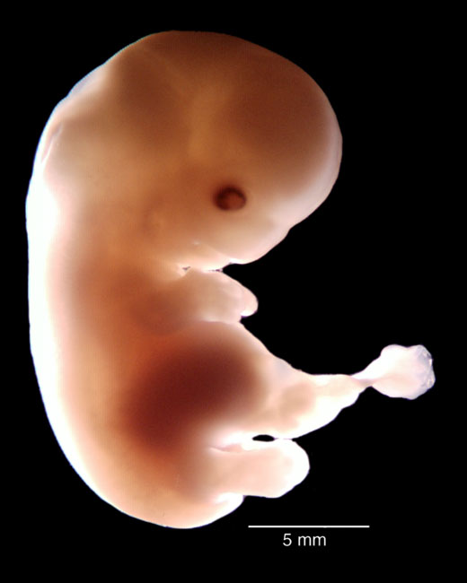 human embryo photograph