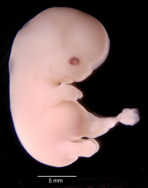 human embryo photograph