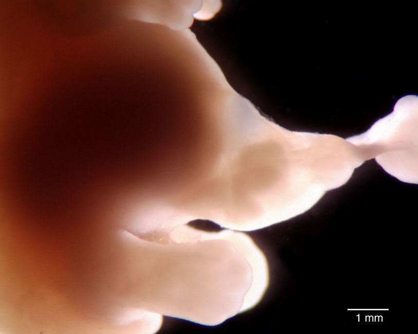 human embryo photograph