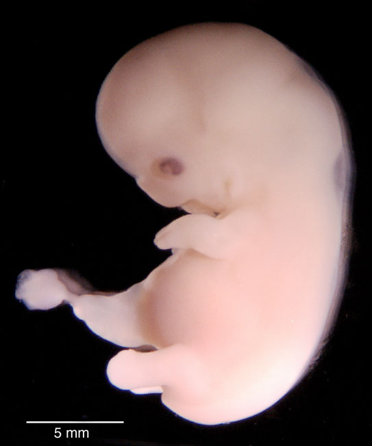 human embryo photograph