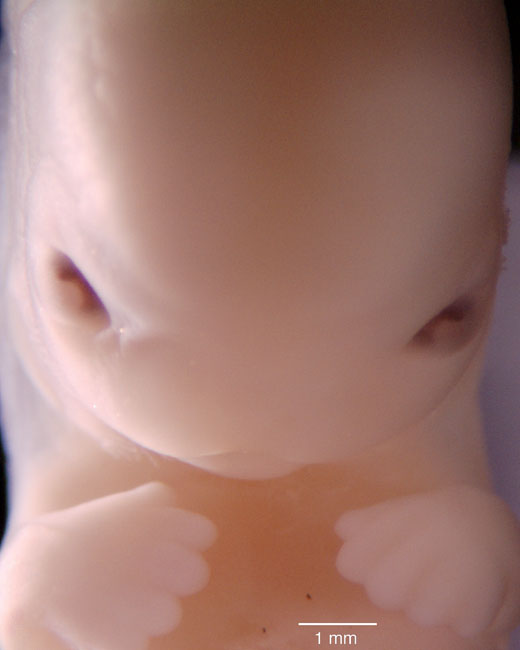 human embryo photograph