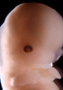 day 50 human embryo photograph