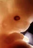 day 50 human embryo photograph