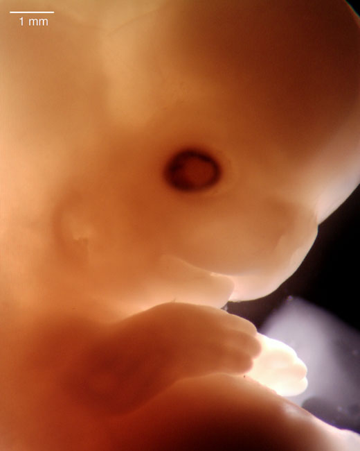 human embryo photograph