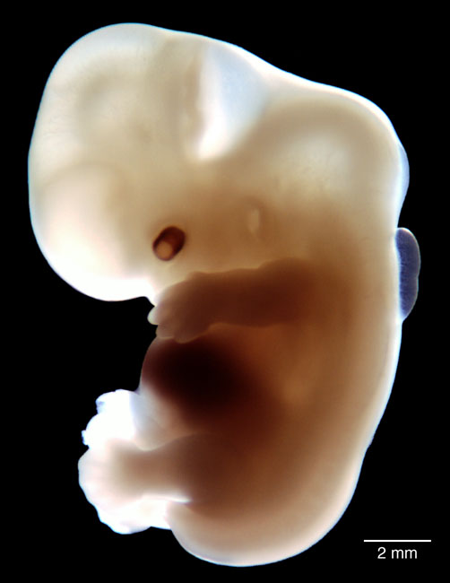 human embryo photograph