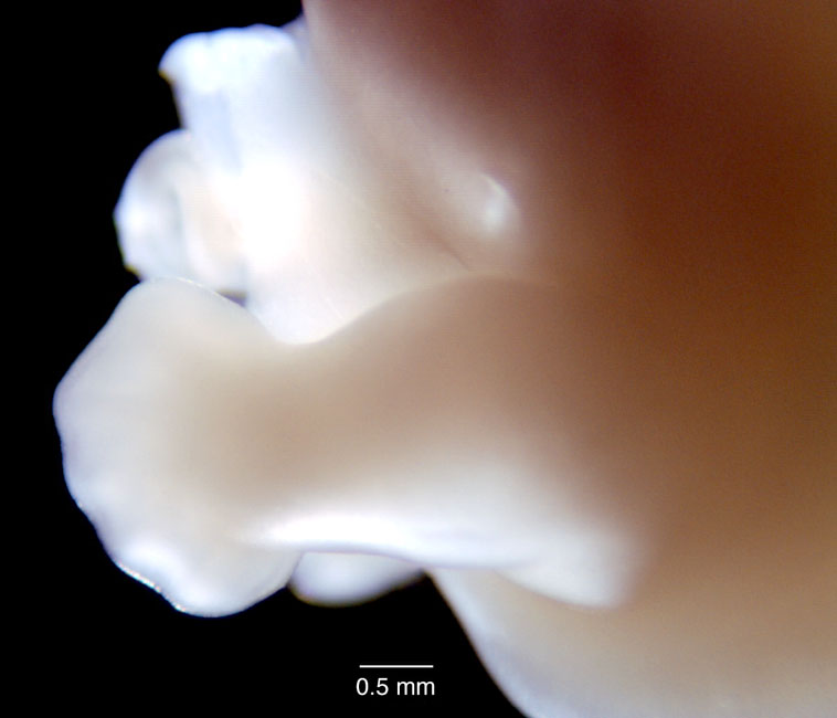 human embryo photograph