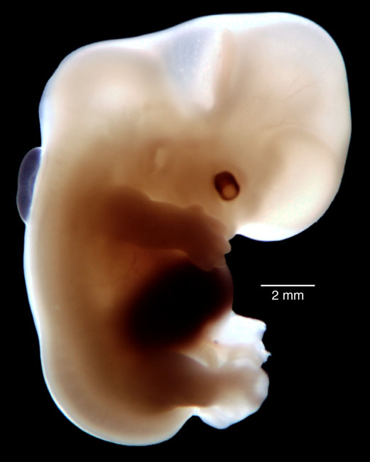 human embryo photograph