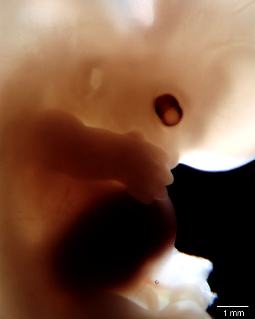 human embryo photograph