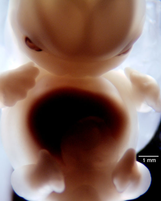 human embryo photograph