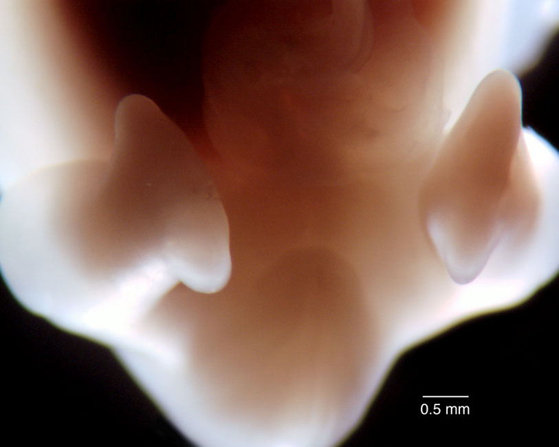 human embryo photograph