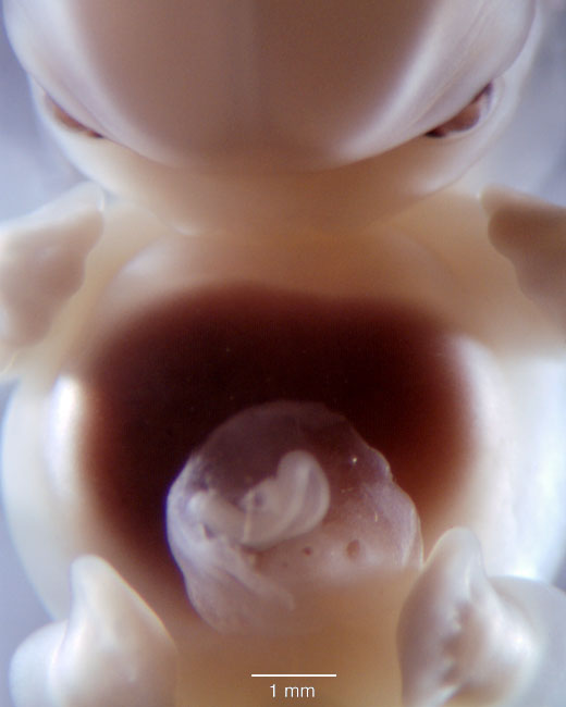 human embryo photograph